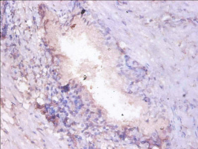 Immunohistochemistry of paraffin-embedded human prostate tissue using PSMA7 Antibody at dilution of 1:100Rabbit anti-Human PSMA7 Polyclonal Antibody