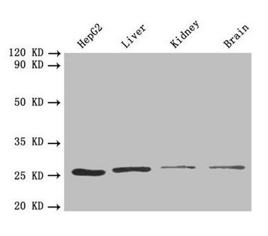 Western blot  | All lanes: PSMA7 antibody at 1.6 µg/ml  | Lane 1: HepG2 whole cell lysate  | Lane 2: Mouse liver tissue  | Lane 3: Mouse kidney tissue  | Lane 4: Mouse brain tissue  | Secondary  | Goat polyclonal to rabbit IgG at 1/10000 dilution  | Predicted band size: 28, 21, 17 kDa  | Observed band size: 28 kDaRabbit anti-Human PSMA7 Polyclonal Antibody