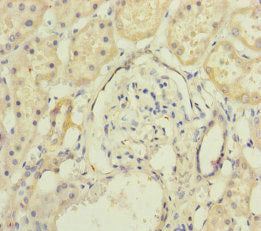 Immunohistochemistry of paraffin-embedded human kidney tissue using MAGOH Antibody at dilution of 1:100