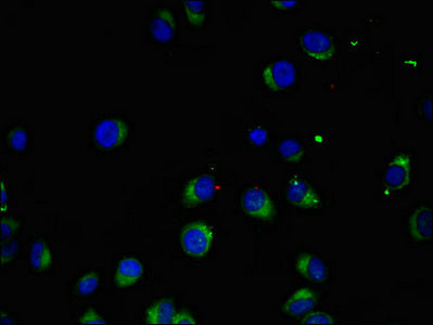Immunofluorescent analysis of A549 cells using MAK Antibody at dilution of 1:100 and Alexa Fluor 488-congugated AffiniPure Goat Anti-Rabbit IgG(H+L)