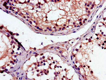 Immunohistochemistry of paraffin-embedded human testis tissue using MAK Antibody at dilution of 1:100