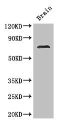 Western Blot | Positive WB detected in: Mouse brain tissue | All lanes: MAK antibody at 2.8μg/ml | Secondary | Goat polyclonal to rabbit IgG at 1/50000 dilution | Predicted band size: 71, 74, 67 kDa | Observed band size: 71 kDa