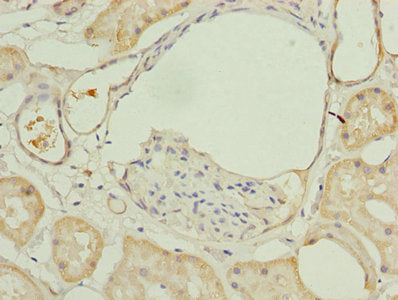 Immunohistochemistry of paraffin-embedded human kidney tissue using MAOA Antibody at dilution of 1:100