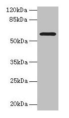 Western blot  | All lanes: MAOA antibody at 1µg/ml + HepG2 whole cell lysate  | Secondary  | Goat polyclonal to rabbit IgG at 1/10000 dilution  | Predicted band size: 60, 45 kDa  | Observed band size: 60 kDa