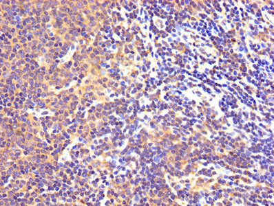 IHC image of MAOB Antibody diluted at 1:300 and staining in paraffin-embedded human lymph node tissue performed on a Leica BondTM system. After dewaxing and hydration, antigen retrieval was mediated by high pressure in a citrate buffer (pH 6.0). Section was blocked with 10% normal goat serum 30min at RT. Then primary antibody (1% BSA) was incubated at 4°C overnight. The primary is detected by a biotinylated secondary antibody and visualized using an HRP conjugated SP system.
