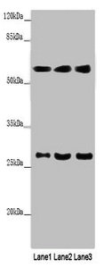 Western blot  | All lanes: MAOB antibody at 9µg/ml  | Lane 1: Mouse liver tissue  | Lane 2: HepG2 whole cell lysate  | Lane 3: A549 whole cell lysate  | Secondary  | Goat polyclonal to rabbit IgG at 1/10000 dilution  | Predicted band size: 59, 47 kDa  | Observed band size: 59, 27 kDa