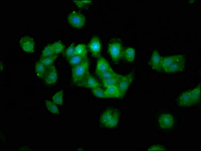 Immunofluorescence staining of HepG2 cells with MAP1A Antibody at 1:133, counter-stained with DAPI. The cells were fixed in 4% formaldehyde, permeabilized using 0.2% Triton X-100 and blocked in 10% normal Goat Serum. The cells were then incubated with the antibody overnight at 4°C. The secondary antibody was Alexa Fluor 488-congugated AffiniPure Goat Anti-Rabbit IgG(H+L).