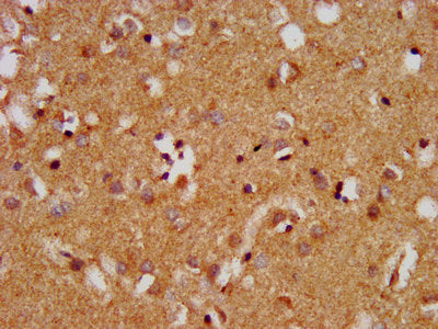 IHC image of the antibody diluted at 1:400 and staining in paraffin-embedded human brain tissue performed on a Leica BondTM system. After dewaxing and hydration, antigen retrieval was mediated by high pressure in a citrate buffer (pH 6.0). Section was blocked with 10% normal goat serum 30min at RT. Then primary antibody (1% BSA) was incubated at 4°C overnight. The primary is detected by a biotinylated secondary antibody and visualized using an HRP conjugated SP system.