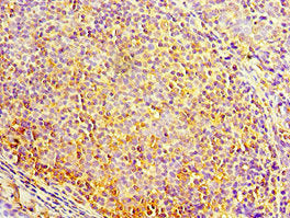 Immunohistochemistry of paraffin-embedded human tonsil tissue using MAP2K3 Antibody at dilution of 1:100