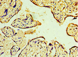 Immunohistochemistry of paraffin-embedded human placenta tissue using MAP2K3 Antibody at dilution of 1:100
