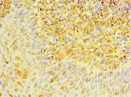Immunohistochemistry of paraffin-embedded human tonsil tissue using MAP2K3 Antibody at dilution of 1:100