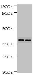 Western blot | All lanes: MAP2K3 antibody at 7μg/ml | Lane 1: MCF-7 whole cell lysate | Lane 2: COLO320 whole cell lysate | Secondary | Goat polyclonal to rabbit IgG at 1/10000 dilution | Predicted band size: 40, 37 kDa | Observed band size: 40 kDa