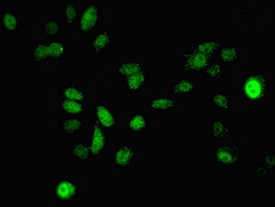 Immunofluorescent analysis of A549 cells using MAP2K3 Antibody at dilution of 1:100 and Alexa Fluor 488-congugated AffiniPure Goat Anti-Rabbit IgG(H+L)