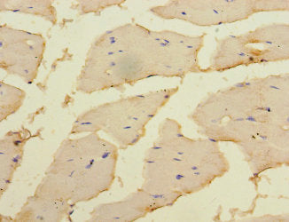 Immunohistochemistry of paraffin-embedded human skeletal muscle tissue using MAP2K3 Antibody at dilution of 1:100