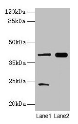 Western blot  | All lanes: MAP2K3 antibody at 10µg/ml  | Lane 1: RAW264.7 whole cell lysate  | Lane 2: Mouse skeletal muscle tissue  | Secondary  | Goat polyclonal to rabbit IgG at 1/10000 dilution  | Predicted band size: 40, 37 kDa  | Observed band size: 40 kDa