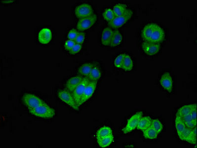 Immunofluorescent analysis of HepG2 cells using MAP2K4 Antibody at dilution of 1:100 and Alexa Fluor 488-congugated AffiniPure Goat Anti-Rabbit IgG(H+L)