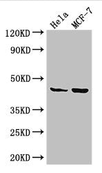 Western Blot | Positive WB detected in: Hela whole cell lysate, MCF-7 whole cell lysate | All lanes: MAP2K4 antibody at 3.25μg/ml | Secondary | Goat polyclonal to rabbit IgG at 1/50000 dilution | Predicted band size: 45, 46 kDa | Observed band size: 45 kDa