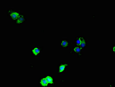Immunofluorescent analysis of Hela cells using MAP3K8 Antibody at dilution of 1:100 and Alexa Fluor 488-congugated AffiniPure Goat Anti-Rabbit IgG(H+L)