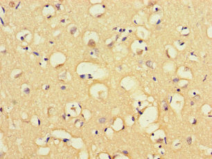Immunohistochemistry of paraffin-embedded human brain tissue using the antibody at dilution of 1:100