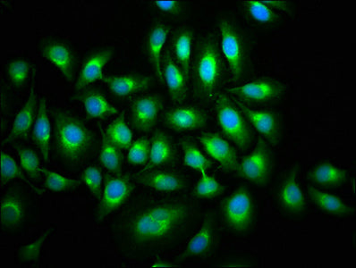 Immunofluorescence staining of A549 cells with MAP3K9 Antibody at 1:133, counter-stained with DAPI. The cells were fixed in 4% formaldehyde, permeabilized using 0.2% Triton X-100 and blocked in 10% normal Goat Serum. The cells were then incubated with the antibody overnight at 4°C. The secondary antibody was Alexa Fluor 488-congugated AffiniPure Goat Anti-Rabbit IgG(H+L).
