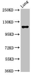 Western Blot | Positive WB detected in: Rat lung tissue | All lanes: MAP3K9 antibody at 2.7μg/ml | Secondary | Goat polyclonal to rabbit IgG at 1/50000 dilution | Predicted band size: 122, 124 kDa | Observed band size: 122 kDa