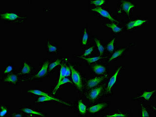 Immunofluorescent analysis of Hela cells using MAP4 Antibody at dilution of 1:100 and Alexa Fluor 488-congugated AffiniPure Goat Anti-Rabbit IgG(H+L)