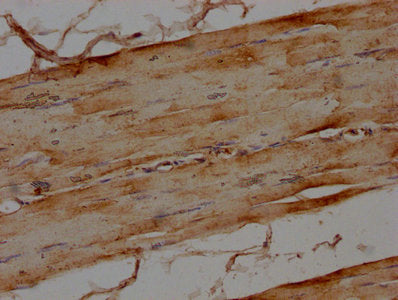 IHC image of MAP4K4 Antibody diluted at 1:100 and staining in paraffin-embedded human skeletal muscle tissue performed on a Leica BondTM system. After dewaxing and hydration, antigen retrieval was mediated by high pressure in a citrate buffer (pH 6.0). Section was blocked with 10% normal goat serum 30min at RT. Then primary antibody (1% BSA) was incubated at 4°C overnight. The primary is detected by a biotinylated secondary antibody and visualized using an HRP conjugated SP system.