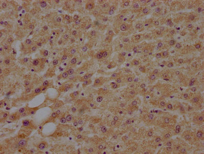 IHC image of MAP4K4 Antibody diluted at 1:100 and staining in paraffin-embedded human liver tissue performed on a Leica BondTM system. After dewaxing and hydration, antigen retrieval was mediated by high pressure in a citrate buffer (pH 6.0). Section was blocked with 10% normal goat serum 30min at RT. Then primary antibody (1% BSA) was incubated at 4°C overnight. The primary is detected by a biotinylated secondary antibody and visualized using an HRP conjugated SP system.