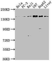 Western Blot | Positive WB detected in: Hela whole cell lysate, PC-3 whole cell lysate, Raji whole cell lysate, U87 whole cell lysate, HepG2 whole cell lysate, Mouse liver tissue | All lanes: MAP4K4 antibody at 1:1000 | Secondary | Goat polyclonal to rabbit IgG at 1/50000 dilution | Predicted band size: 143, 139, 151, 134, 142, 146 kDa | Observed band size: 143 kDa