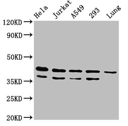 Western Blot | Positive WB detected in: Hela whole cell lysate, Jurkat whole cell lysate, A549 whole cell lysate, 293 whole cell lysate, Rat lung tissue | All lanes: MAPK1 antibody at 4.8μg/ml | Secondary | Goat polyclonal to rabbit IgG at 1/50000 dilution | Predicted band size: 42, 37 kDa | Observed band size: 42, 37 kDa