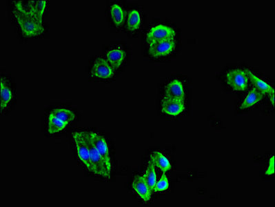 Immunofluorescent analysis of HepG2 cells using MAPK10 Antibody at dilution of 1:100 and Alexa Fluor 488-congugated AffiniPure Goat Anti-Rabbit IgG(H+L)