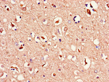 Immunohistochemistry of paraffin-embedded human brain tissue using the antibody at dilution of 1:100
