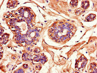 Immunohistochemistry of paraffin-embedded human testis tissue using MAPK10 Antibody at dilution of 1:100