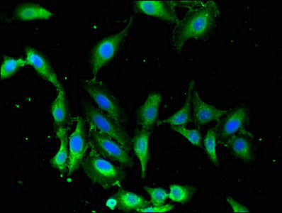 Immunofluorescent analysis of Hela cells using MAPK12 Antibody at dilution of 1:100 and Alexa Fluor 488-congugated AffiniPure Goat Anti-Rabbit IgG(H+L)