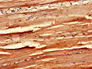 Immunohistochemistry of paraffin-embedded human skeletal muscle tissue using MAPK12 Antibody at dilution of 1:100