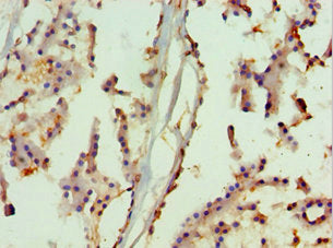 Immunohistochemistry of paraffin-embedded human prostate tissue using MAPK13 Antibody at dilution of 1:100