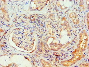 Immunohistochemistry of paraffin-embedded human kidney tissue using MAPK13 Antibody at dilution of 1:100