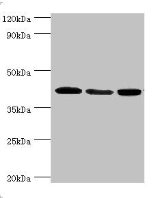 Western blot | All lanes: Mitogen-activated protein kinase 13 antibody at 3μg/ml | Lane 1: HepG2 whole cell lysate | Lane 2: Hela whole cell lysate | Lane 3: MCF-7 whole cell lysate | Secondary | Goat polyclonal to rabbit IgG at 1/10000 dilution | Predicted band size: 43, 29 kDa | Observed band size: 43 kDa