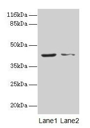 Western blot  | All lanes: MAPK13 antibody at 2µg/ml  | Lane 1: Hela whole cell lysate  | Lane 2: A549 whole cell lysate  | Secondary  | Goat polyclonal to rabbit IgG at 1/10000 dilution  | Predicted band size: 43, 29 kDa  | Observed band size: 43 kDa
