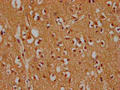 IHC image of MAPK14 Antibody diluted at 1:300 and staining in paraffin-embedded human brain tissue performed on a Leica BondTM system. After dewaxing and hydration, antigen retrieval was mediated by high pressure in a citrate buffer (pH 6.0). Section was blocked with 10% normal goat serum 30min at RT. Then primary antibody (1% BSA) was incubated at 4°C overnight. The primary is detected by a biotinylated secondary antibody and visualized using an HRP conjugated SP system.