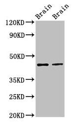 Western Blot  | Positive WB detected in: Rat brain tissue, Mouse brain tissue  | All lanes: MAPK3 antibody at 3µg/ml  | Secondary  | Goat polyclonal to rabbit IgG at 1/50000 dilution  | Predicted band size: 44, 39, 41 kDa  | Observed band size: 44 kDa