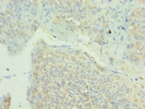 Immunohistochemistry of paraffin-embedded human tonsil tissue using MAPK4 Antibody at dilution of 1:100