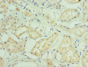 Immunohistochemistry of paraffin-embedded human kidney tissue using MAPK4 Antibody at dilution of 1:100