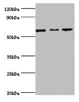 Western blot | All lanes: MAPK4 ntibody at 6μg/ml | Lane 1: Mouse brain tissue | Lane 2: 293T whole cell lysate | Lane 3: Jurkat whole cell lysate | Secondary | Goat polyclonal to rabbit IgG at 1/10000 dilution | Predicted band size: 66 kDa | Observed band size: 66 kDa