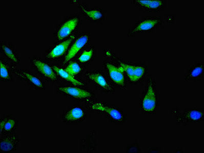 Immunofluorescent analysis of Hela cells using PSMB7 Antibody at dilution of 1:100 and Alexa Fluor 488-congugated AffiniPure Goat Anti-Rabbit IgG(H+L)Rabbit anti-Human PSMB7 Polyclonal Antibody