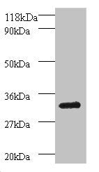 Western blot | All lanes: Proteasome subunit beta type-7 antibody at 2μg/ml + 293T whole cell lysate | Secondary | Goat polyclonal to rabbit IgG at 1/15000 dilution | Predicted band size: 30, 16 kDa | Observed band size: 30 kDaRabbit anti-Human PSMB7 Polyclonal Antibody