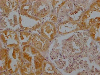 IHC image of MAS1 Antibody diluted at 1:200 and staining in paraffin-embedded human kidney tissue performed on a Leica BondTM system. After dewaxing and hydration, antigen retrieval was mediated by high pressure in a citrate buffer (pH 6.0). Section was blocked with 10% normal goat serum 30min at RT. Then primary antibody (1% BSA) was incubated at 4°C overnight. The primary is detected by a Goat anti-rabbit polymer IgG labeled by HRP and visualized using 0.05% DAB.