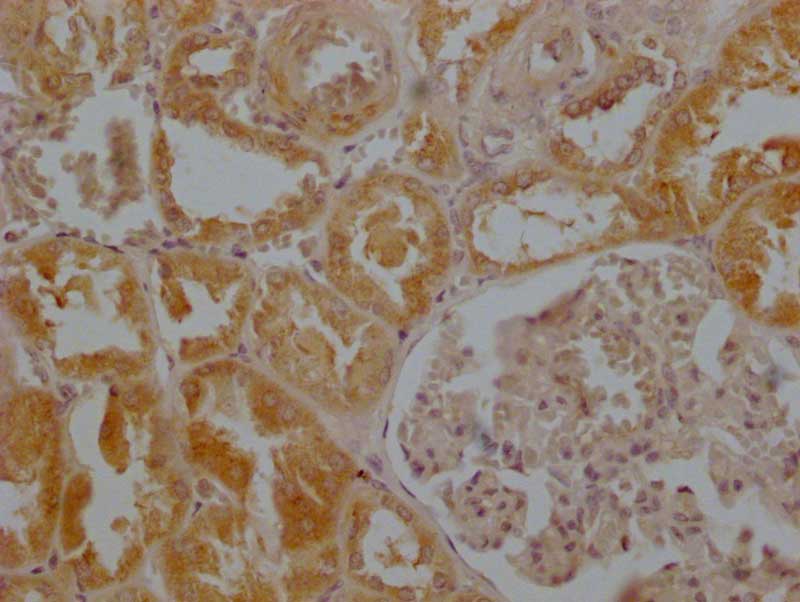 IHC image of MAS1 Antibody diluted at 1:200 and staining in paraffin-embedded human kidney tissue performed on a Leica BondTM system. After dewaxing and hydration, antigen retrieval was mediated by high pressure in a citrate buffer (pH 6.0). Section was blocked with 10% normal goat serum 30min at RT. Then primary antibody (1% BSA) was incubated at 4°C overnight. The primary is detected by a Goat anti-rabbit polymer IgG labeled by HRP and visualized using 0.05% DAB.