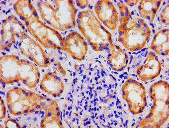 Immunohistochemistry of paraffin-embedded human kidney tissue using MAST3 Antibody at dilution of 1:100