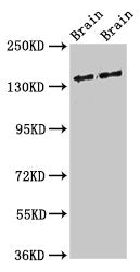 Western Blot | Positive WB detected in: Rat brain tissue, Mouse brain tissue | All lanes: MAST3 antibody at 3μg/ml | Secondary | Goat polyclonal to rabbit IgG at 1/50000 dilution | Predicted band size: 144 kDa | Observed band size: 144 kDa